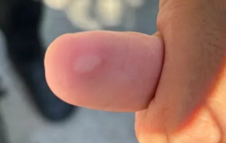 为什么在外面千万不要用手摸行李箱的轮子？