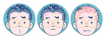 头皮上的黄色小颗粒，到底是啥？