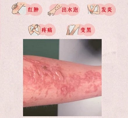 在夏天的阳光下剥橙子，为什么是作死？