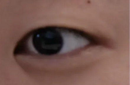 为什么有的人下眼睑最外面会有一条线？