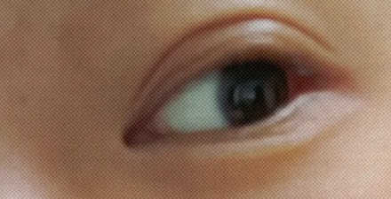为什么有的人下眼睑最外面会有一条线？