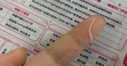 为什么有的人的嘴角总会有条白白黏黏的分泌物?