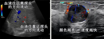 既然有「B 超」，那有「A 超」和「C 超」吗？