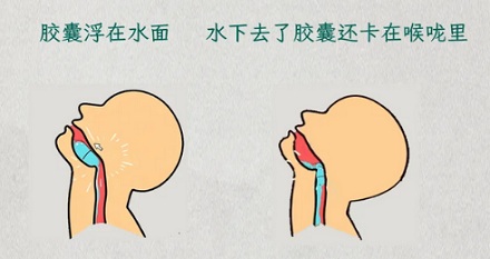 为什么胶囊药不要仰着头服用而要低着头？