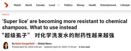 为什么发达的欧美很多孩子还会长头虱，他们还觉得特正常？