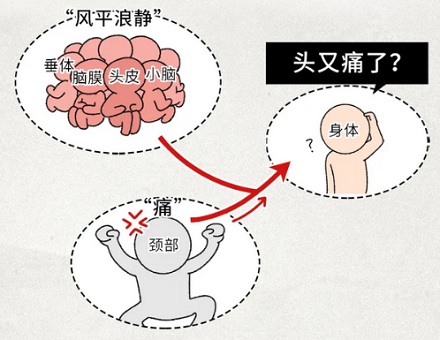 大脑明明没有痛觉，为什么会感到头痛欲裂？