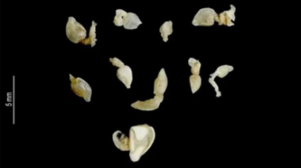 为啥梭子蟹鳃里密密麻麻的「寄生虫」，根本不用怕？