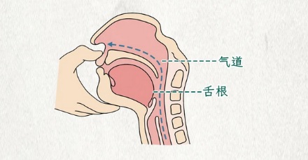 遇到有人晕倒，为什么干万不能冲上去掐人中？