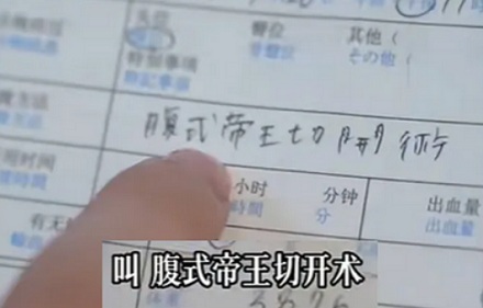 为什么日语里的「剖腹产」叫作「帝王切开」？