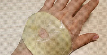 为什么输液后手背上红肿，有人会用土豆片敷？