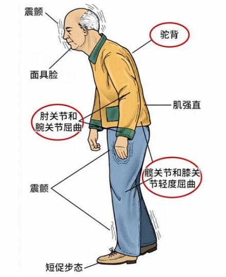 在路上遇到走小碎步的老人，为什么千万不能按喇叭？
